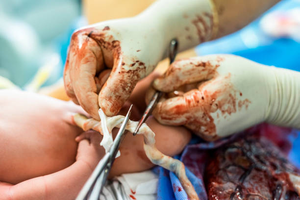 cutting the umbilical cord between a newborn baby and placenta - placenta baby childbirth newborn imagens e fotografias de stock