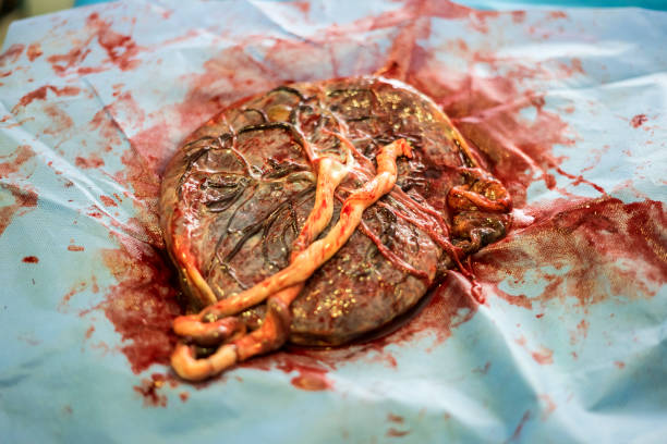 placenta outside uterus just after childbirth - placenta baby childbirth newborn imagens e fotografias de stock