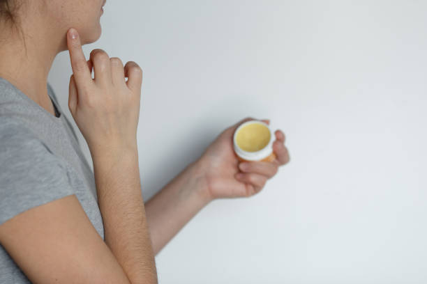 istock Female applying balm moisturizing balsam 973771142