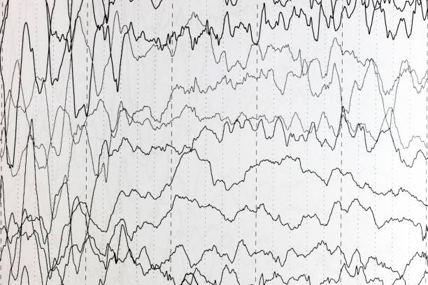 istock Brain wave patterns on electroencephalogram, EEG of the pediatric patients, problems in the electrical activity of the brain. 973851258