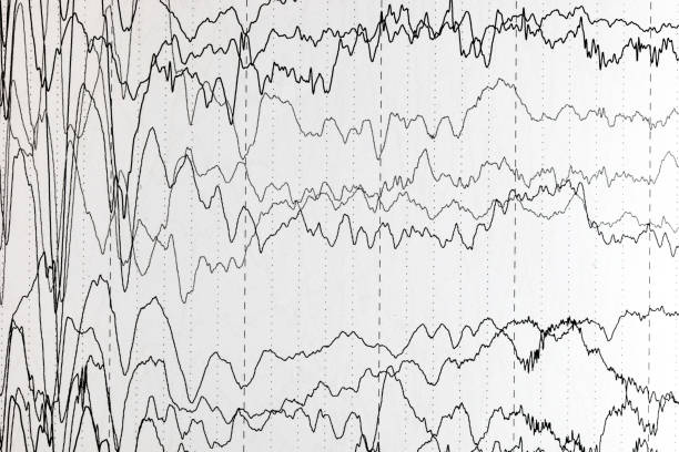 gehirnwellenmuster auf elektroenzephalogramm, eeg der pädiatrischen patienten, probleme in der elektrischen aktivität des gehirns. - eeg epilepsy science electrode stock-fotos und bilder