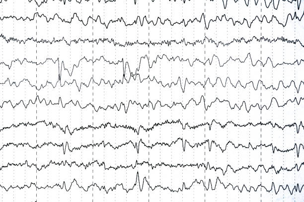 gehirnwellenmuster auf elektroenzephalogramm, eeg der pädiatrischen patienten, probleme in der elektrischen aktivität des gehirns. - eeg epilepsy science electrode stock-fotos und bilder