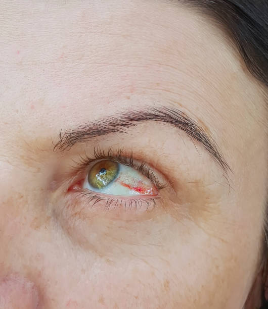 istock woman red eyes 973935496