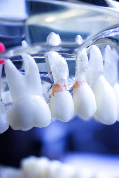 istock Dentist dental teeth teaching model showing each tooth and gum for patients and students. 973939006