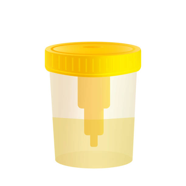 Realistic sample of your urine in a jar with a yellow cap. Medical check of tests vector art illustration