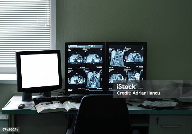 Angiografia Por Ressonância Magnética Na Médicos Escritório - Fotografias de stock e mais imagens de Tomografia Computorizada