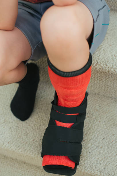 istock Boys foot in cast 974944270