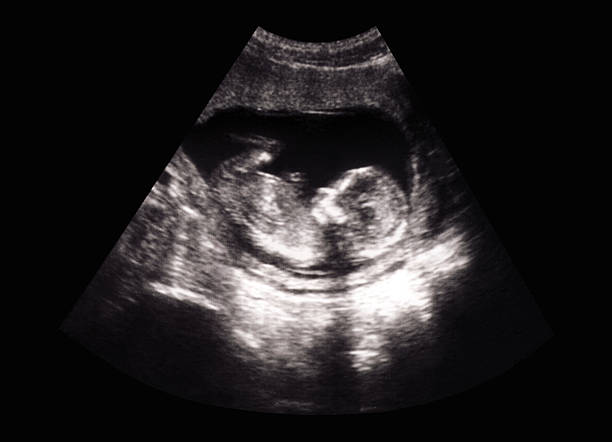 Fetus ultrasound stock photo