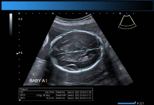 identyczne bliźniacze chłopcy położnictwa usg - twin fetus uterus human pregnancy zdjęcia i obrazy z banku zdjęć