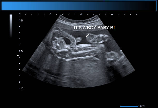 istock Identical twin boys obstetrical ultrasound 975032576