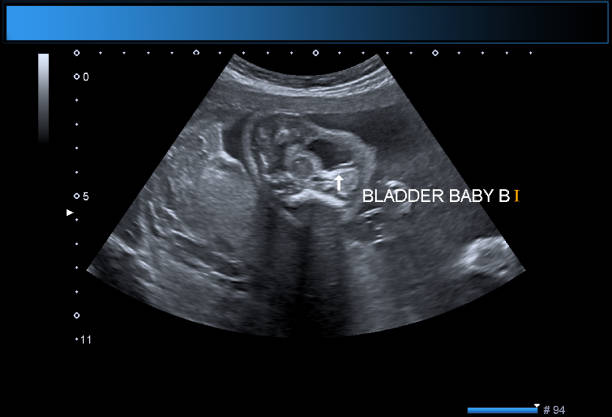 istock Identical twin boys obstetrical ultrasound 975032598