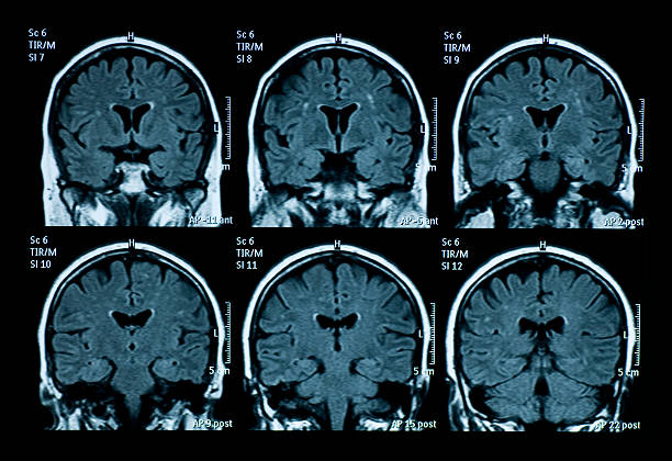 mri scan des gehirns - mri scanner stock-fotos und bilder