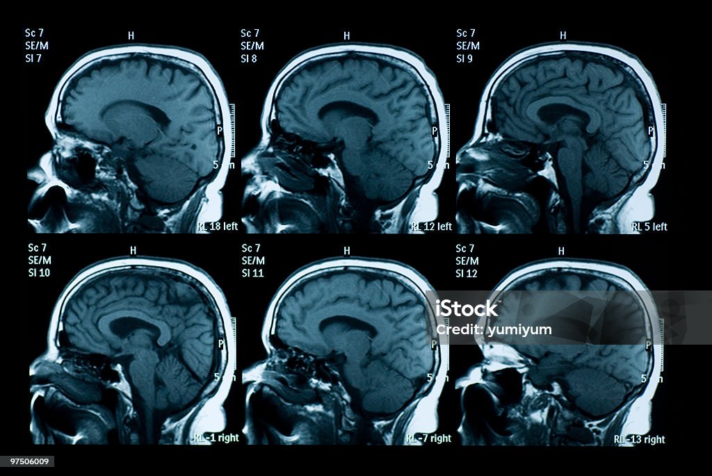 Image à résonance magnétique de cerveau - Photo de Scanner à résonance magnétique libre de droits