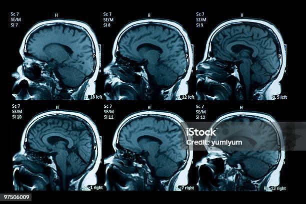 Photo libre de droit de Image À Résonance Magnétique De Cerveau banque d'images et plus d'images libres de droit de Scanner à résonance magnétique - Scanner à résonance magnétique, Image par résonance magnétique, Scanographie