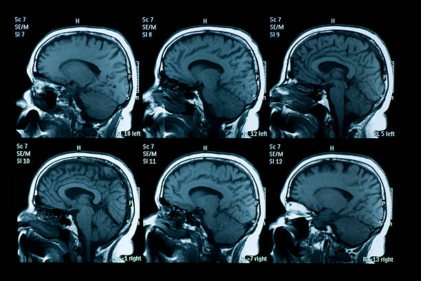 мрт-сканирование головного мозга - brain mri scanner mri scan medical scan стоковые фото и изображения