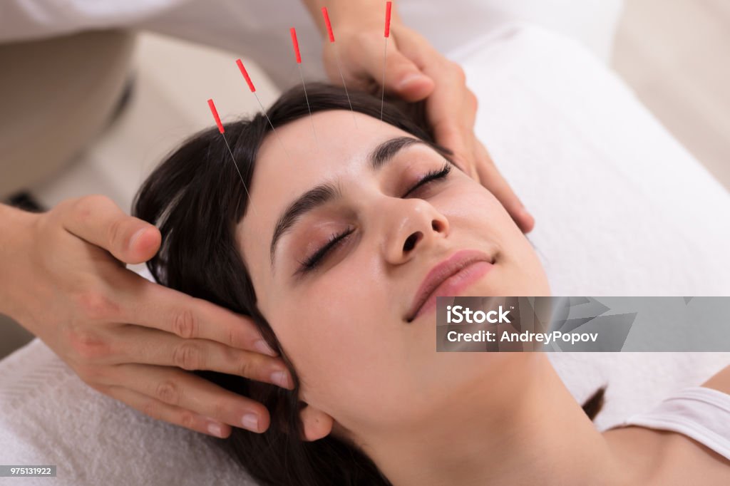 Woman Receiving Acupuncture Treatment Relaxed Young Woman Receiving Acupuncture Treatment In Beauty Spa Acupuncture Stock Photo