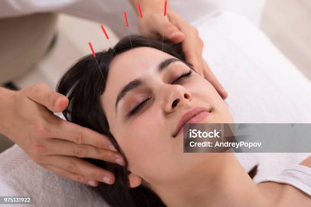 Woman Receiving Acupuncture Treatment Stock Photo - Download Image Now - Acupuncture, Facial Mask - Beauty Product, Acupuncturist