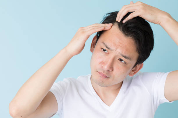 portrait of young asian man isolated on blue background - hair loss imagens e fotografias de stock