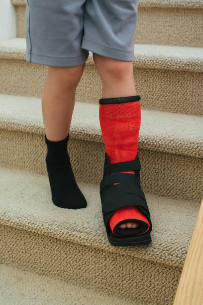istock Boy walking on stairs with foot cast 975583834