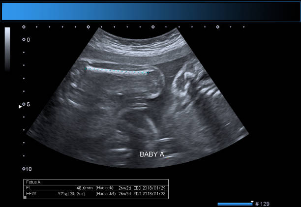 istock Identical twin boys obstetrical ultrasound 975772130