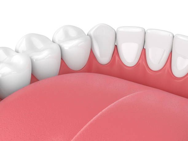 istock 3d render of jaw model with teeth over white 976788700