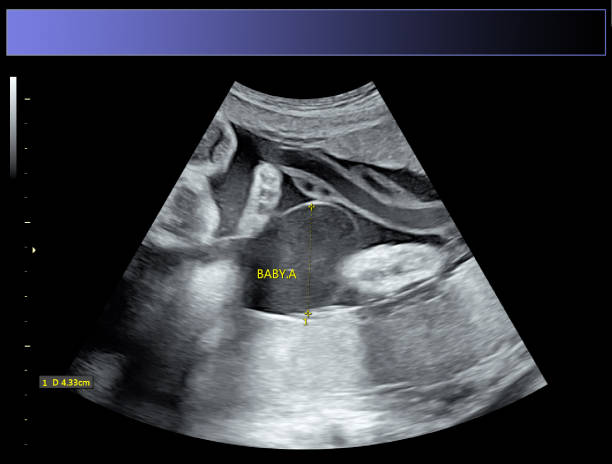 istock Identical twin boys obstetrical ultrasound 976926994