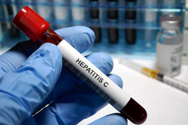 Hepatitis C treatment stock photo