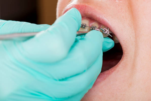 istock Boy with braces. Dental check up 977369416