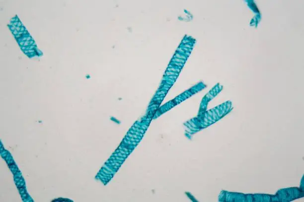 Photo of Spirogyra alga under the microscope