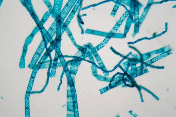 Photo of Spirogyra alga under the microscope