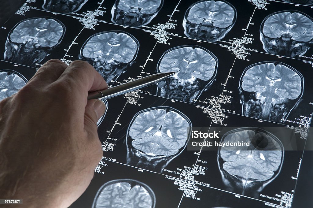 Scanner à résonance magnétique de cerveau tête crâne et os avec Main pointant du doigt - Photo de Maladie d'Alzheimer libre de droits