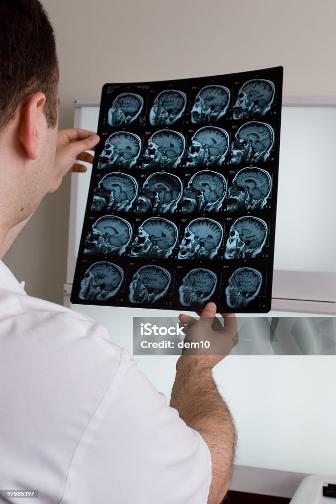 Magnetic resonance imaging 자기공명영상 - 로열티 프리 단층 촬영 스톡 사진