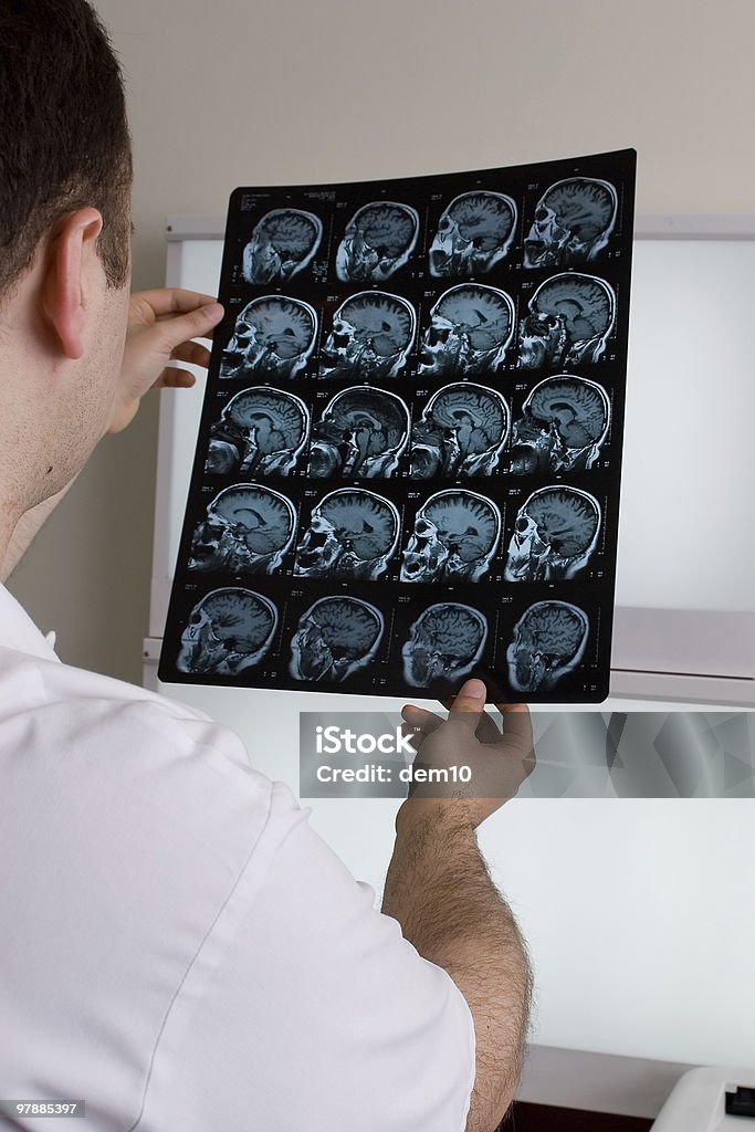 Магнитно-резонансная томография - Стоковые фото Томография роялти-фри
