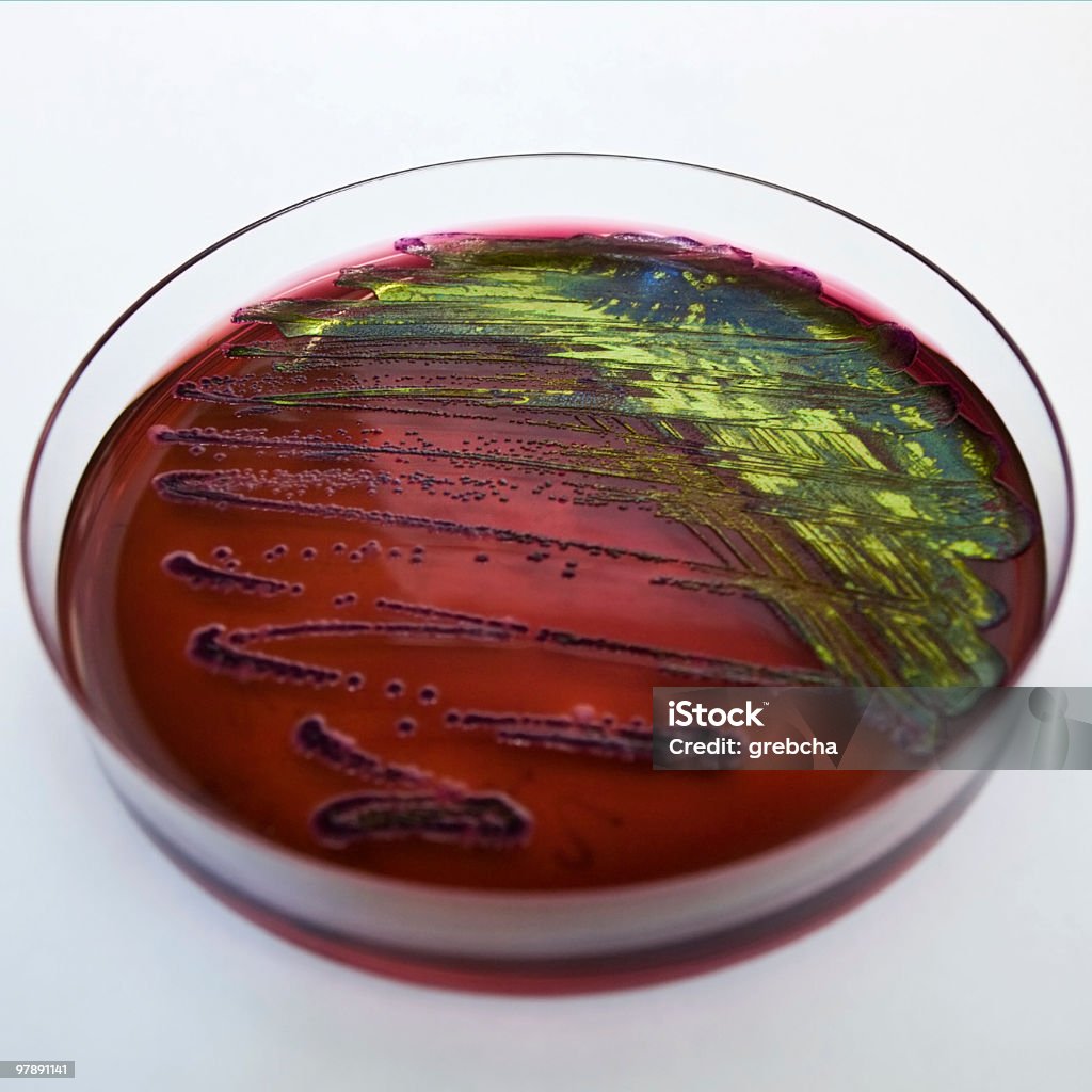 Petrischale mit Bakterien - Lizenzfrei Agargel Stock-Foto