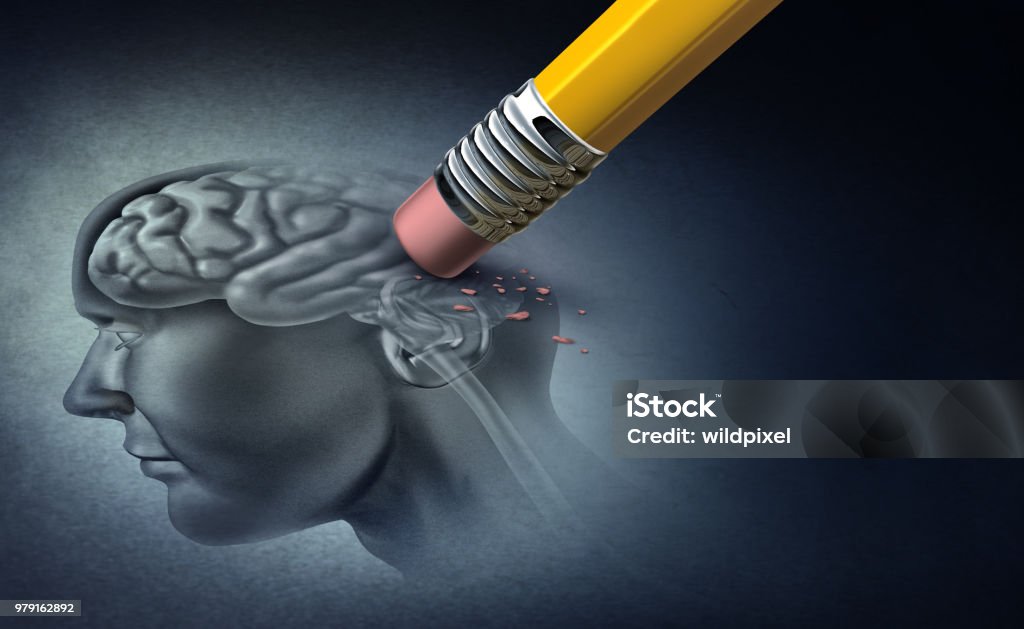 Concept Of Memory Loss Concept of memory loss and dementia disease and losing brain function memories as an alzheimers health symbol of neurology and mental problems with 3D illustration elements. Alzheimer's Disease Stock Photo