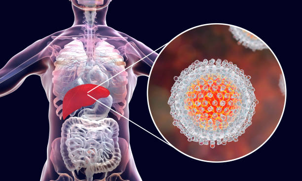 concept médical infection à virus de l’hépatite c - hepatitis virus photos et images de collection