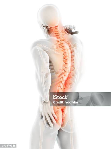 3d Illustration Of Sacral And Cervical Painful Stock Photo - Download Image Now - Backache, The Human Body, Cut Out