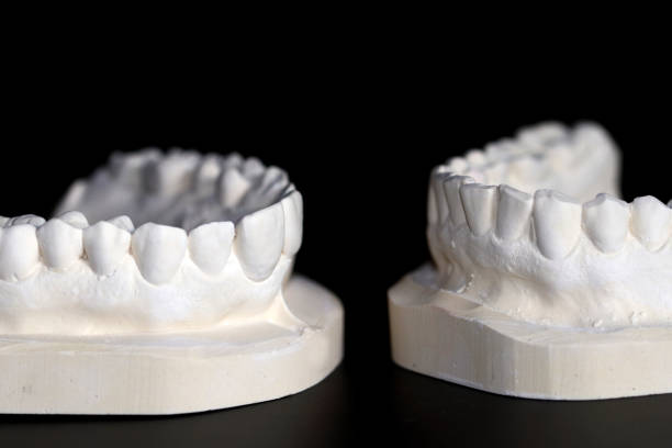 istock Upper and lower teeth made of plaster 979912308