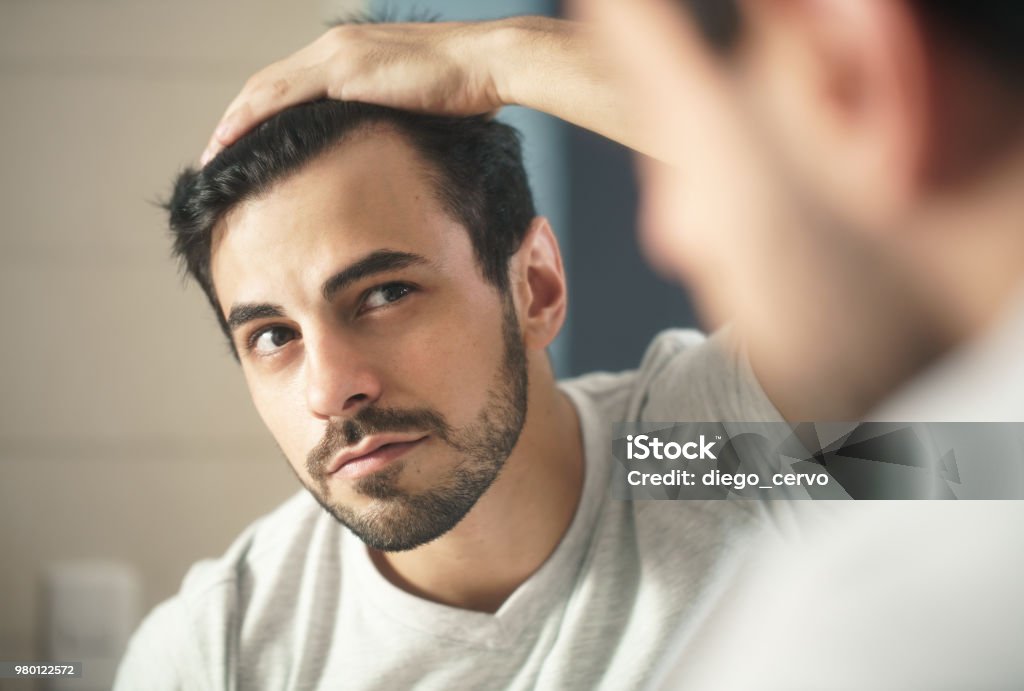 Homem preocupado para Alopecia procura perda de cabelo - Foto de stock de Homens royalty-free