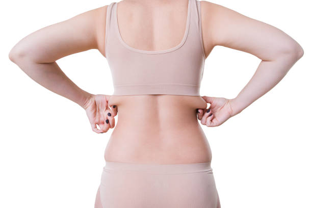 피부 여 자가 들고 배, 흰색 바탕에 고립 된 여성 신체에 셀 룰 라이트 - bra 뉴스 사진 이미지