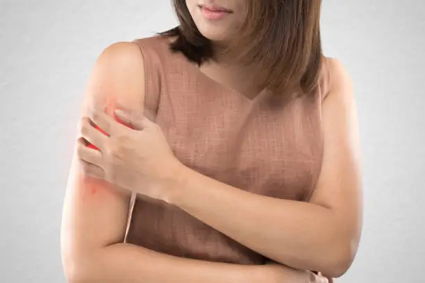 Asian women who are itching from insect bites against gray wall background. / Health care and medicine. / People with skin problem concept.