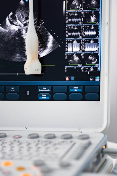istock The ultrasound screen with the image and the sensor on the screen 981318728