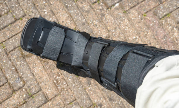 black walker as orthopedic device after ankle surgery - cast in stone imagens e fotografias de stock