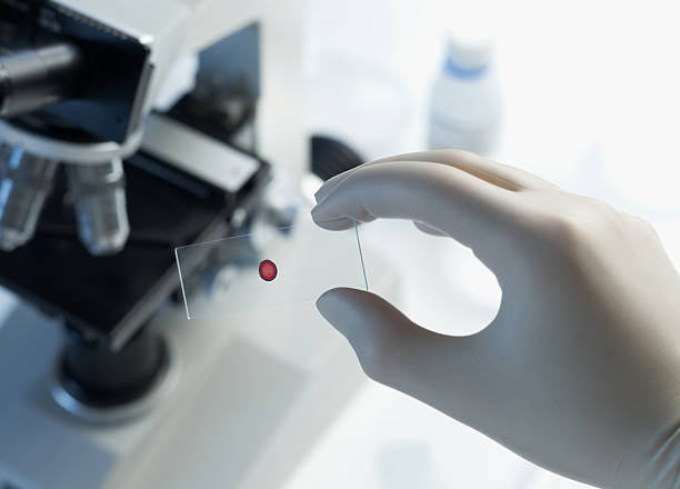 Scientist holding blood sample slide stock photo