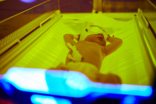 menina de bebê recém-nascido recebendo fototerapia para icterícia - yellowing - fotografias e filmes do acervo