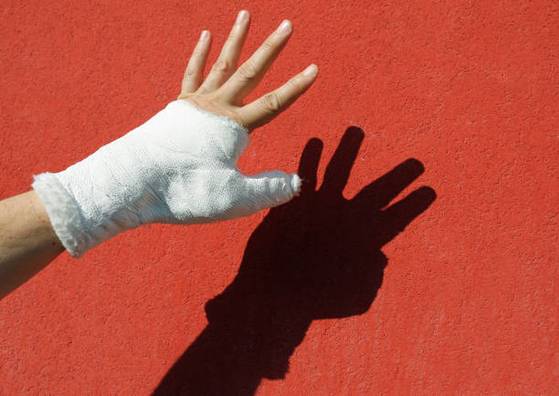 wrist plastered following a domestic accident against the background of a red wall