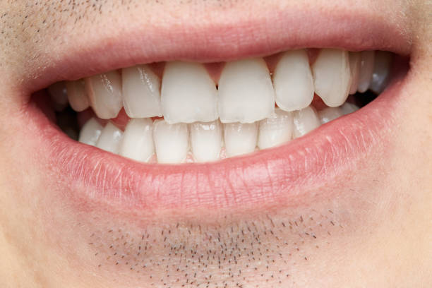 istock Close-up of mans smile 983410968