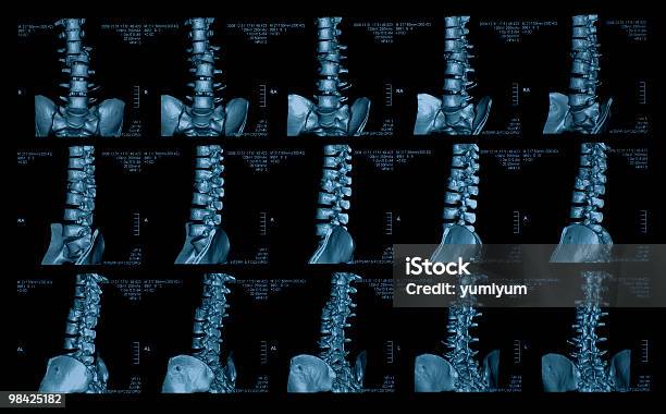 Vértebra Foto de stock y más banco de imágenes de Anatomía - Anatomía, Asistencia sanitaria y medicina, Color - Tipo de imagen