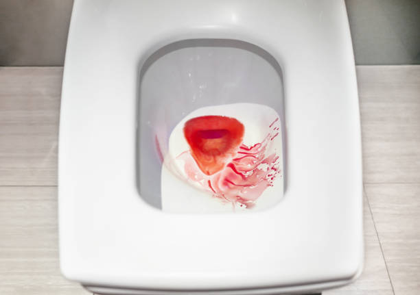 Blut in der Toilette mit Wasserspülung – Foto