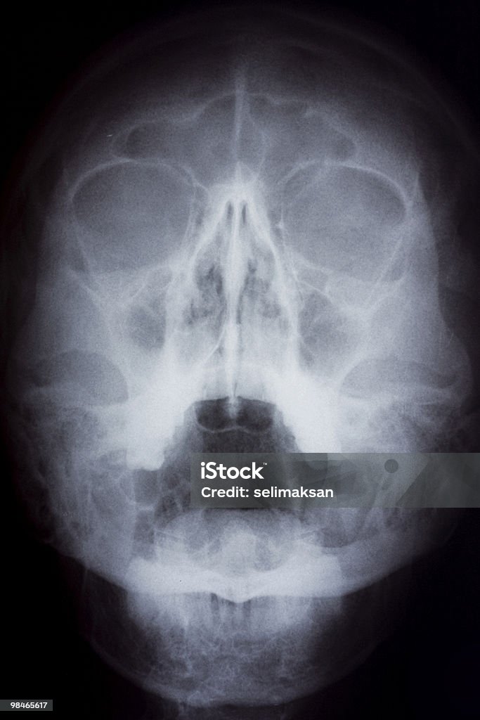 Imagen de rayos X de cráneo humano - Foto de stock de Anatomía libre de derechos